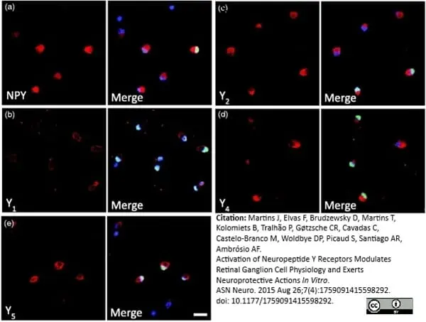 Anti Human Neuropeptide Y Receptor 1 Antibody gallery image 2