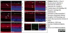 Anti Human Neuropeptide Y Receptor 1 Antibody gallery image 3