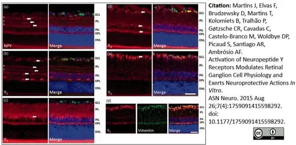 Anti Human Neuropeptide Y Receptor 1 Antibody gallery image 3