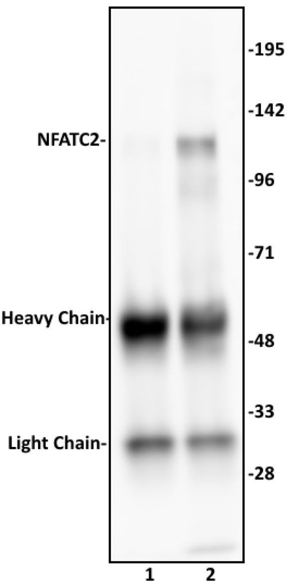 Anti Human NFATC2 Antibody gallery image 1