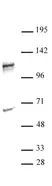 Anti Human NFATC2 Antibody thumbnail image 2
