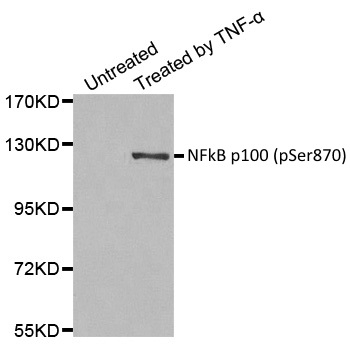 Anti NFkB p100 (pSer870) Antibody gallery image 1