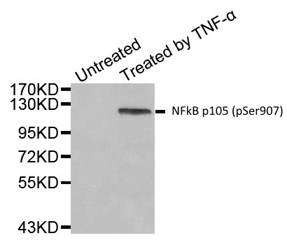 Anti NFkB p105 (pSer907) Antibody gallery image 1