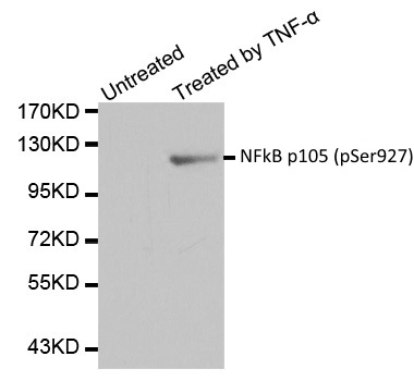 Anti NFkB p105 (pSer927) Antibody gallery image 1