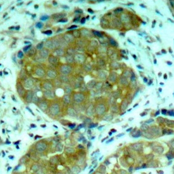 Anti NFkB p105 (pSer932) Antibody gallery image 2