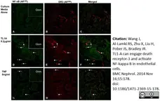 Anti NFkB p65 Antibody gallery image 1