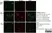 Anti NFkB p65 Antibody thumbnail image 1