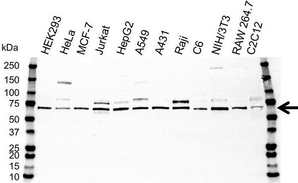 Anti NFkB p65 Antibody (PrecisionAb Polyclonal Antibody) gallery image 5