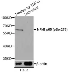 Anti NFkB p65 (pSer276) Antibody gallery image 1