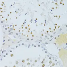 Anti NFkB p65 (pSer276) Antibody gallery image 2