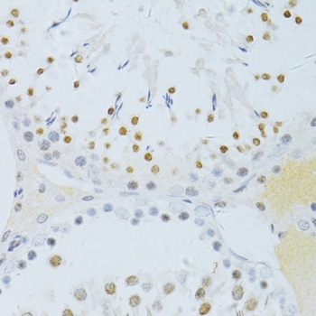Anti NFkB p65 (pSer276) Antibody gallery image 2