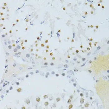 Anti NFkB p65 (pSer276) Antibody gallery image 2