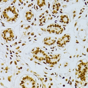 Anti NFkB p65 (pSer276) Antibody thumbnail image 3