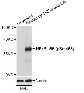 Anti NFkB p65 (pSer468) Antibody gallery image 1