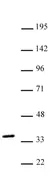 Anti Human NKX2.5 Antibody thumbnail image 1