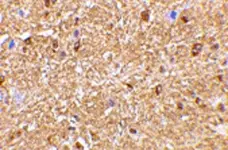 Anti Human NogoA (N-Terminal) Antibody gallery image 2