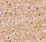 Anti Human NogoA (N-Terminal) Antibody thumbnail image 1