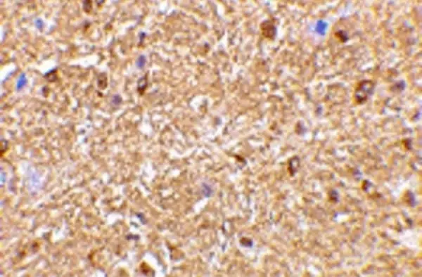 Anti Human NogoA (N-Terminal) Antibody gallery image 2