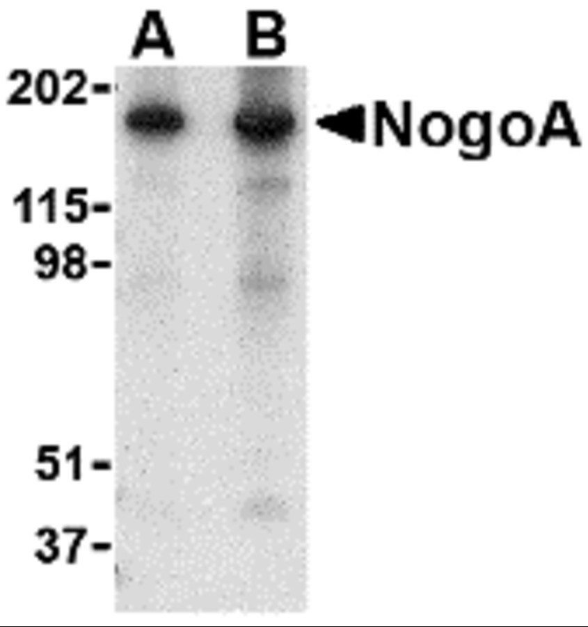 Anti Human NogoA (N-Terminal) Antibody gallery image 1