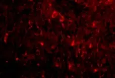 Anti Human NogoA (N-Terminal) Antibody gallery image 3
