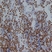 Anti Human Non-Neuronal Enolase Antibody (Polyclonal Antibody Antibody) thumbnail image 1