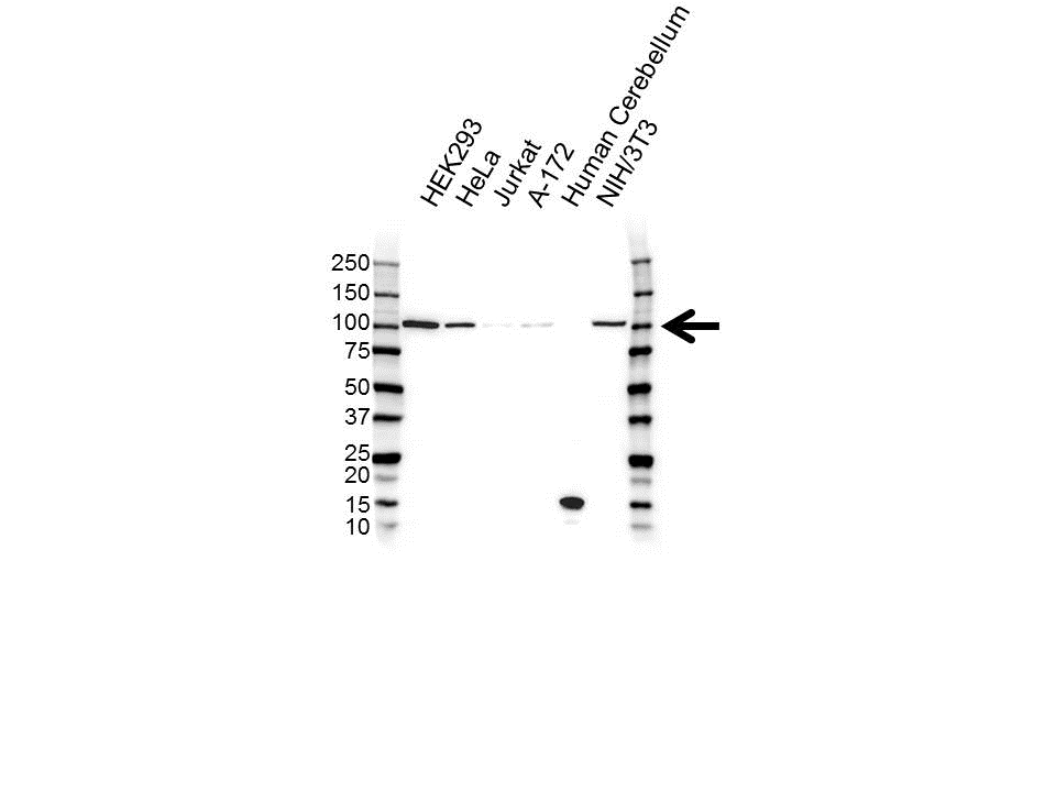Anti Npepps Antibody (PrecisionAb Polyclonal Antibody) gallery image 1
