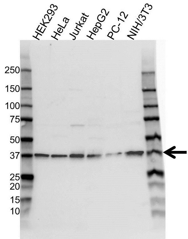 Anti NPM Antibody (PrecisionAb Polyclonal Antibody) gallery image 1