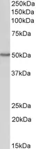 Anti OAS1 Antibody thumbnail image 1