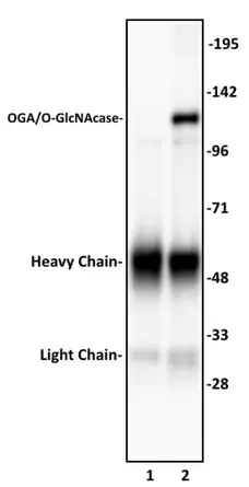 Anti Human OGA Antibody gallery image 1