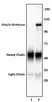 Anti Human OGA Antibody thumbnail image 1