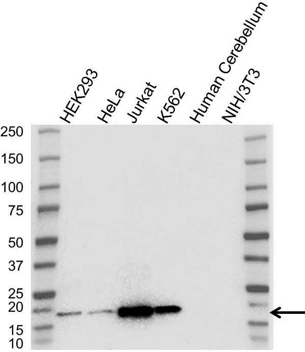 Anti OP18 Antibody (PrecisionAb Polyclonal Antibody) gallery image 1