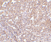 Anti ORAI1 (C-Terminal) Antibody gallery image 2