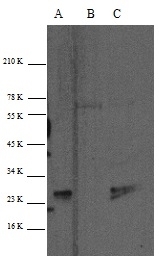 Anti p27/Kip1 Antibody gallery image 1