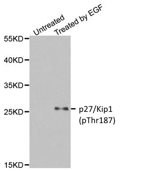 Anti p27/Kip1 (pThr187) Antibody gallery image 1