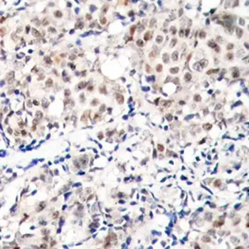 Anti p27/Kip1 (pThr187) Antibody gallery image 2