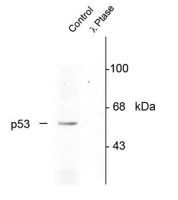 Anti p53 (pSer392) Antibody gallery image 1