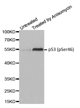 Anti p53 (pSer46) Antibody gallery image 1