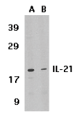 Anti p53DINP1 Antibody gallery image 1