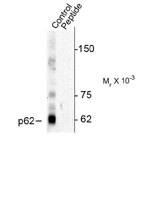 Anti p62 (pThr269/pSer272) Antibody gallery image 1