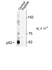 Anti p62 (pThr269/pSer272) Antibody thumbnail image 1