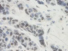 Anti Human PAI-1 Antibody gallery image 1