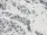 Anti Human PAI-1 Antibody thumbnail image 1