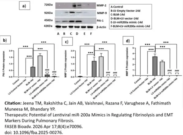 Anti Human PAI-1 Antibody gallery image 2