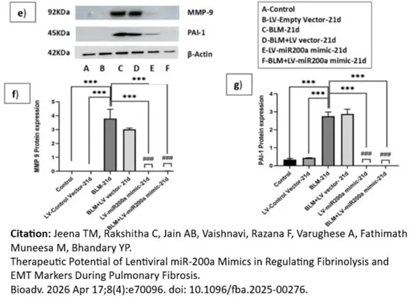 Anti Human PAI-1 Antibody gallery image 3