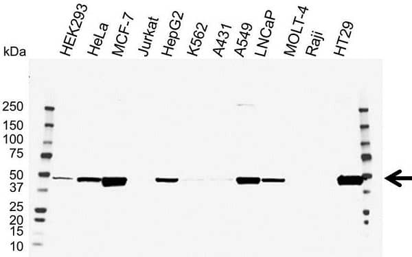 Anti PAI-1 Antibody (PrecisionAb Polyclonal Antibody) gallery image 1