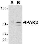 Anti PAK2 Antibody (PrecisionAb Polyclonal Antibody) gallery image 3