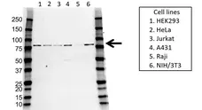 Anti PAK6 Antibody (PrecisionAb Polyclonal Antibody) gallery image 1