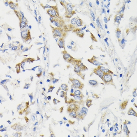 Anti PDHA1 Antibody | Bio-Rad