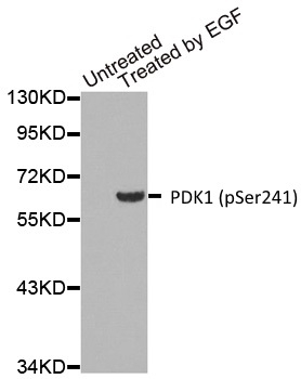 Anti PDK1 (pSer241) Antibody gallery image 1