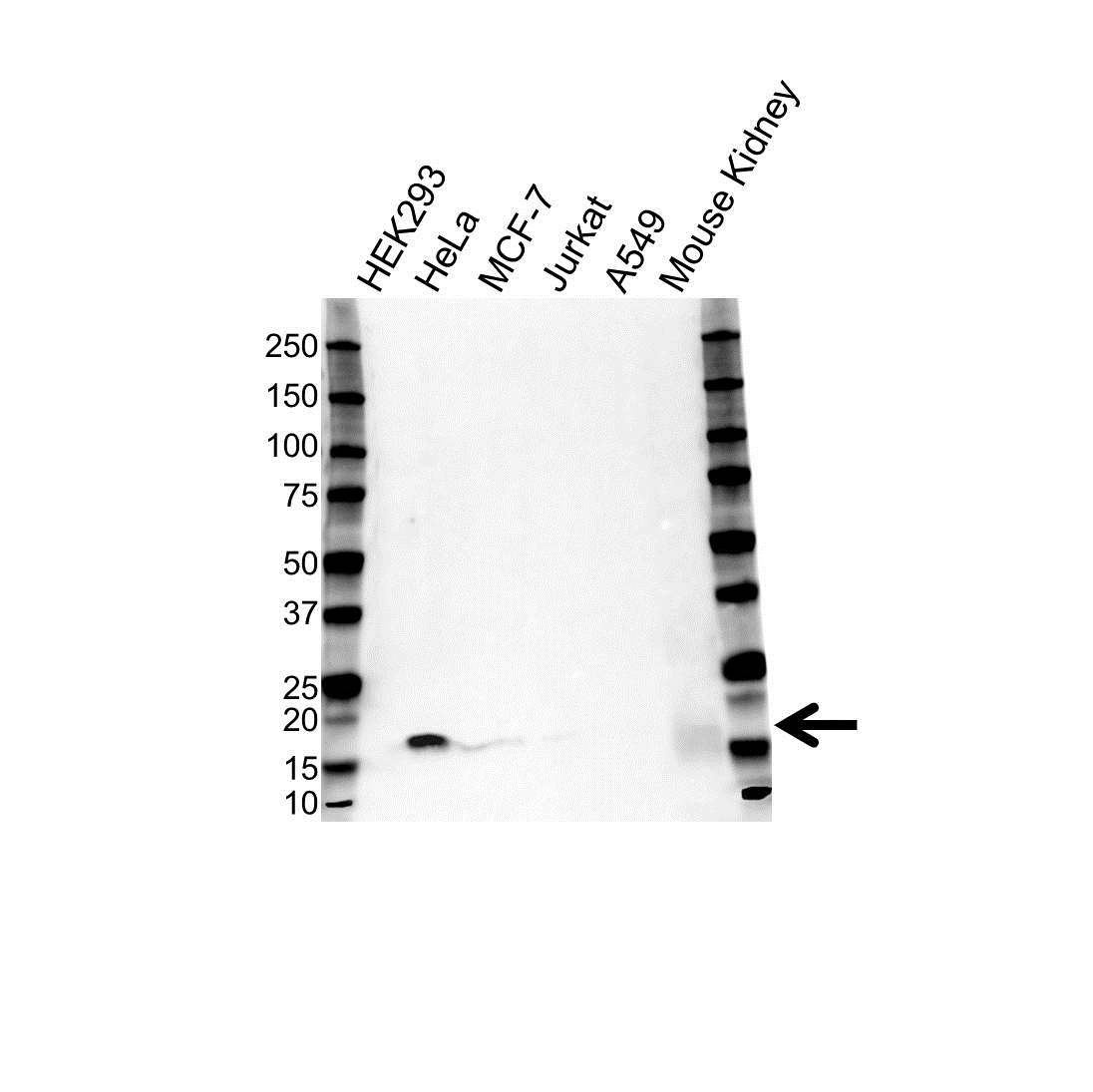 Anti Peroxiredoxin 5 Antibody (PrecisionAb Polyclonal Antibody) gallery image 1